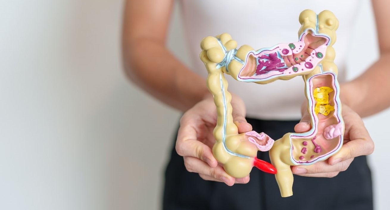 a doctor pointing to a colon medical tool