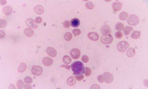 microscopic depiction of cyclosporiasis germs